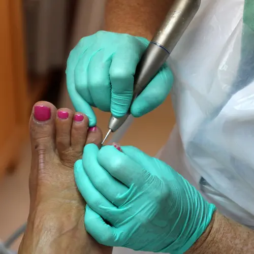 cosmetic pedicure